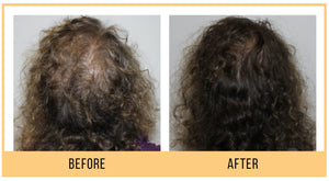 Scalp and Hair Growth Serum by Keravive