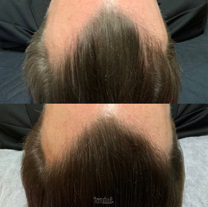 Scalp and Hair Growth Serum by Keravive