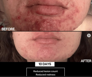 SIV Biome Balancing Serum