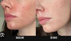 SIV Biome Balancing Serum