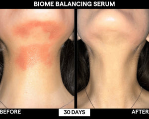 SIV Biome Balancing Serum